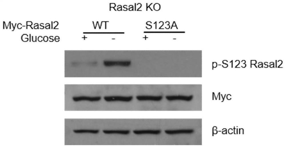 Rasal2 protein 123-site phosphorylation specific antibody, preparation method and ELISA detection kit