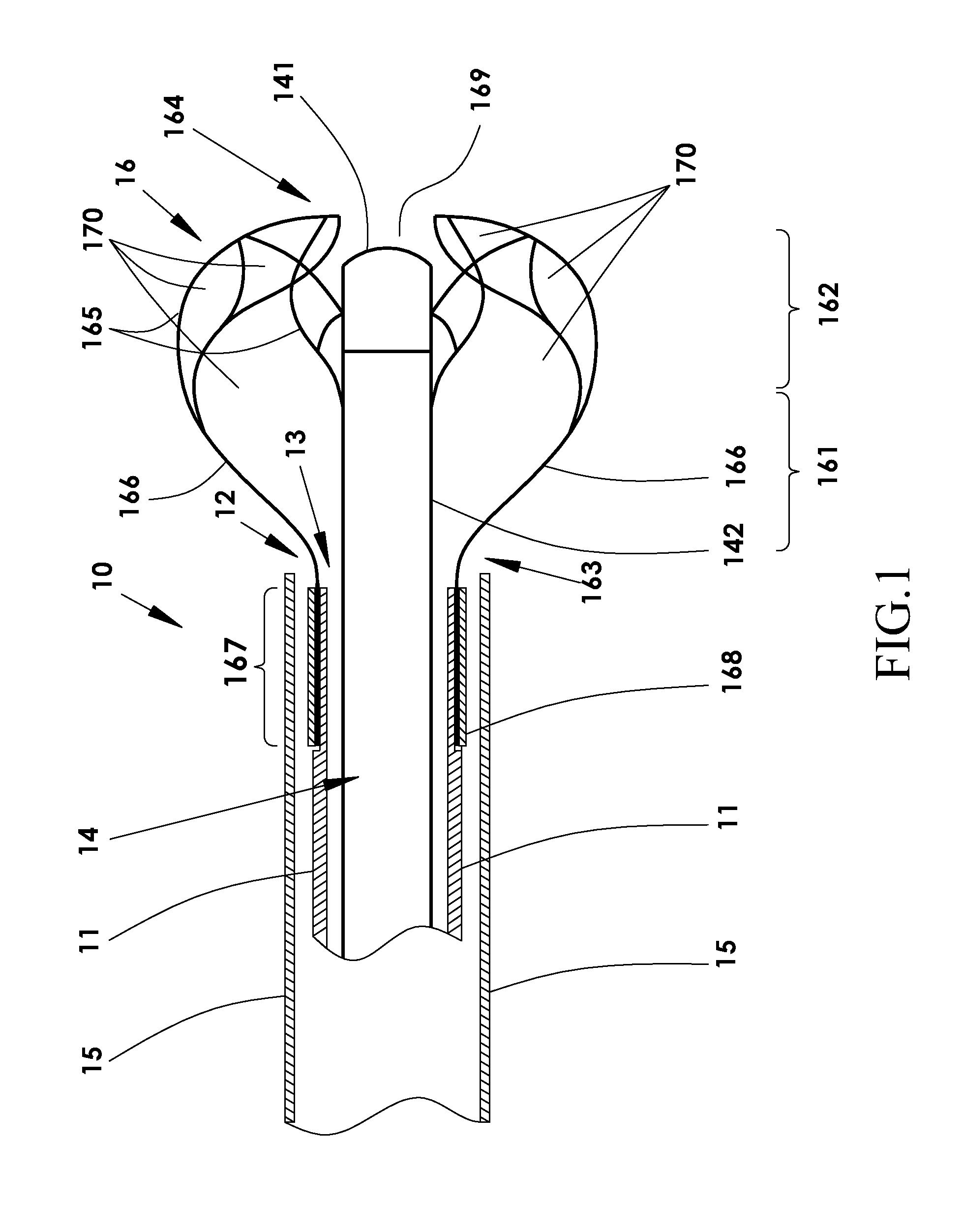 Device and method for fragmenting and removing concretions from body ducts and cavities