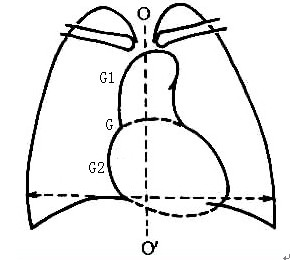 Abnormal heart great vessel computer screening system and screening method on basis of adult X-ray normal position chest radiography