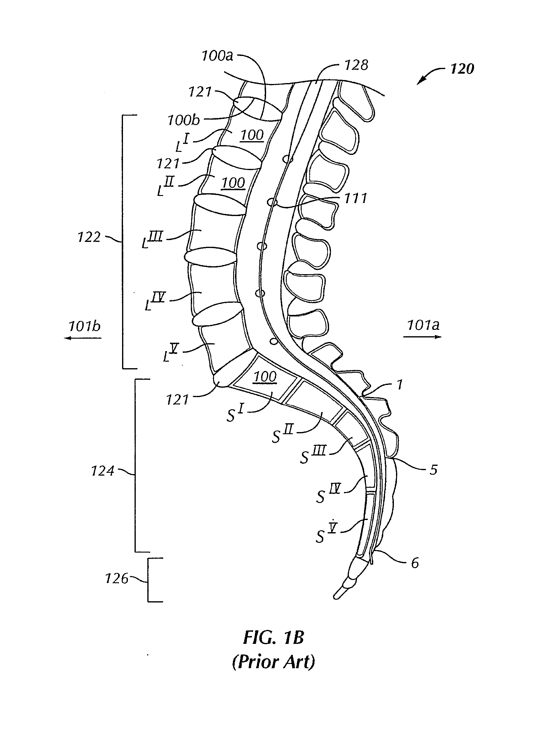 Internal fixation system for spine surgery