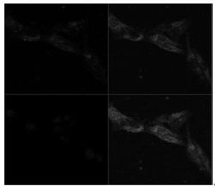 A kind of endoplasmic reticulum membrane fusion liposome and its preparation method and application