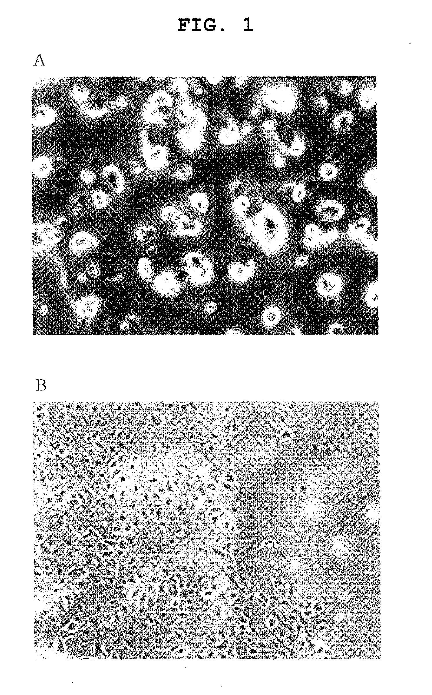 Agent for promoting corneal endothelial cell adhesion