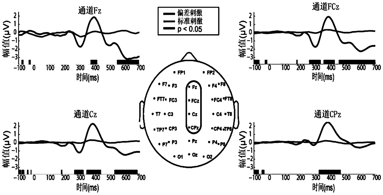 Evaluation method of auditory startle based on brain-computer interface assisted crs-r scale