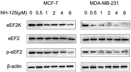 Tumor radiosensitizers containing eEF2K inhibitors