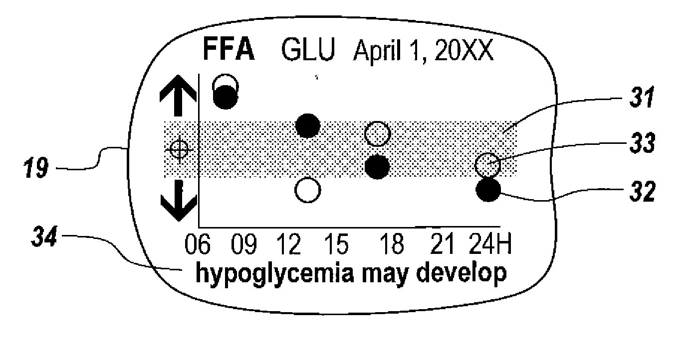 Method and Device for Utilizing Analyte Levels to Assist in the Treatment of Diabetes