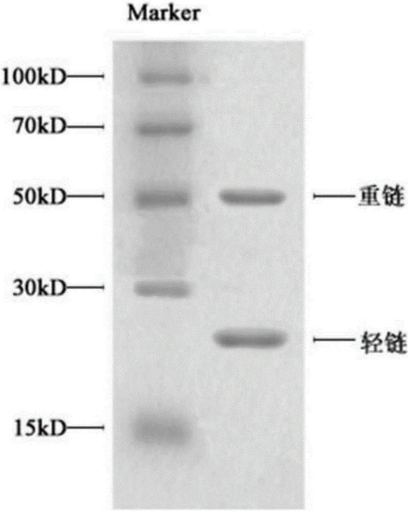 Monoclonal antibody of candida mannan and preparation method of monoclonal antibody