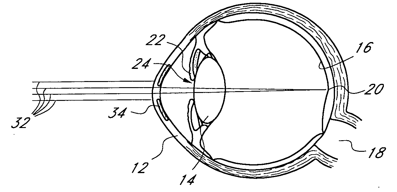 Mask configured to maintain nutrient transport without producing visible diffraction patterns