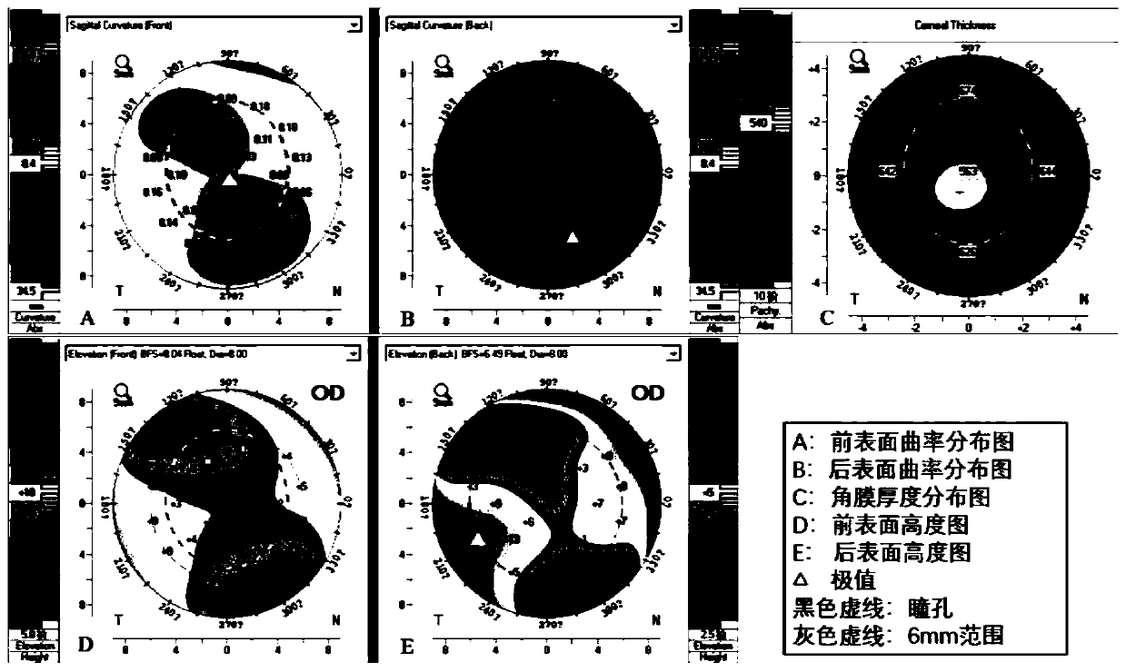 Method for expressing corneal irregularity structure changes based on change consistency parameters of anterior segment tomography technology