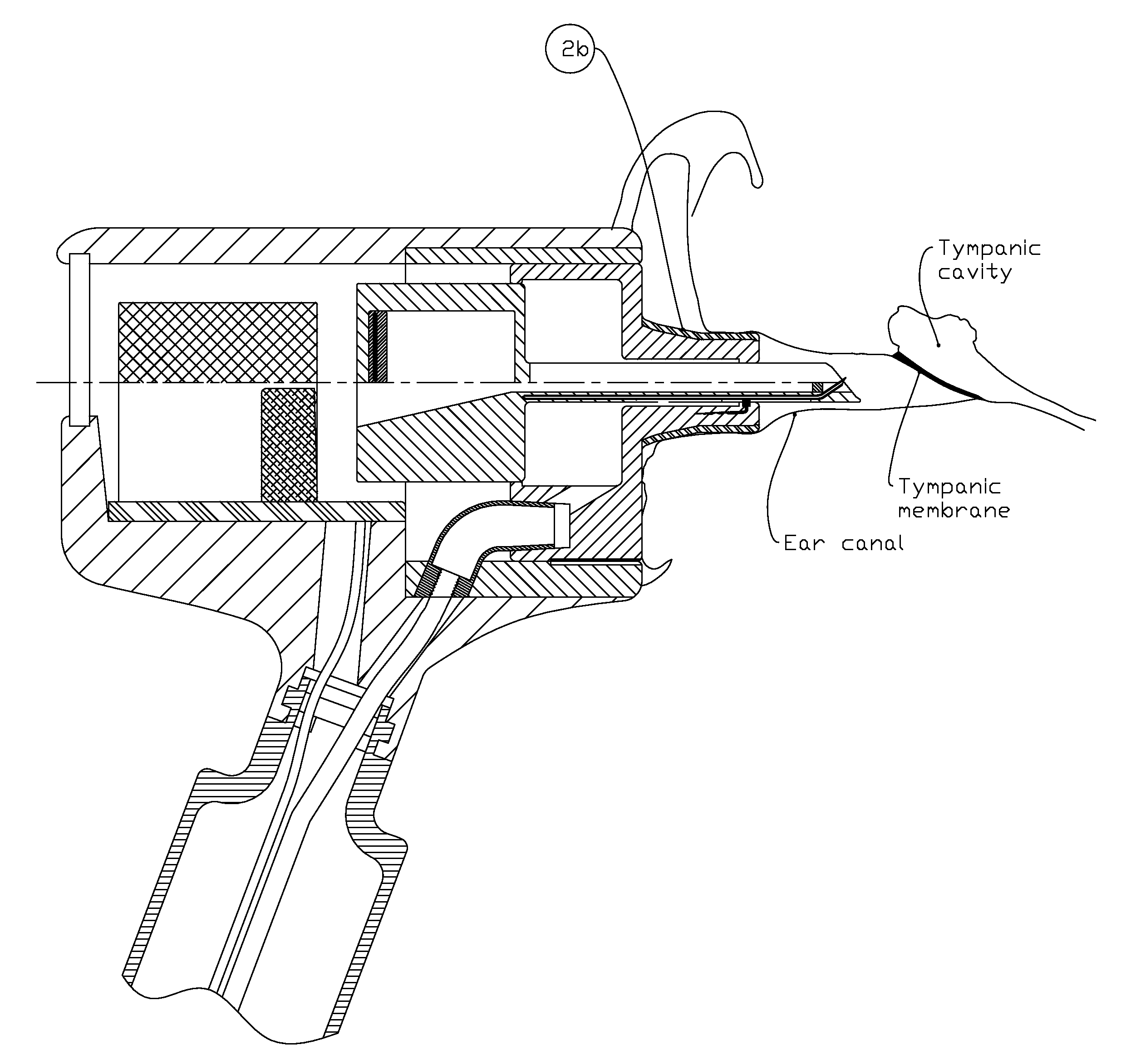 Device and method for delivering medicine into the tympanic cavity,with sliding assist