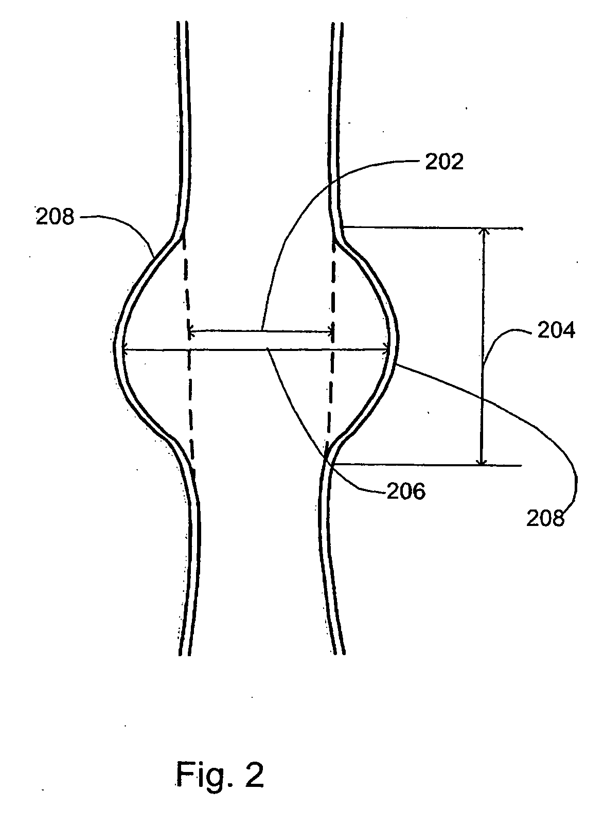 Methods and devices for extravascular intervention