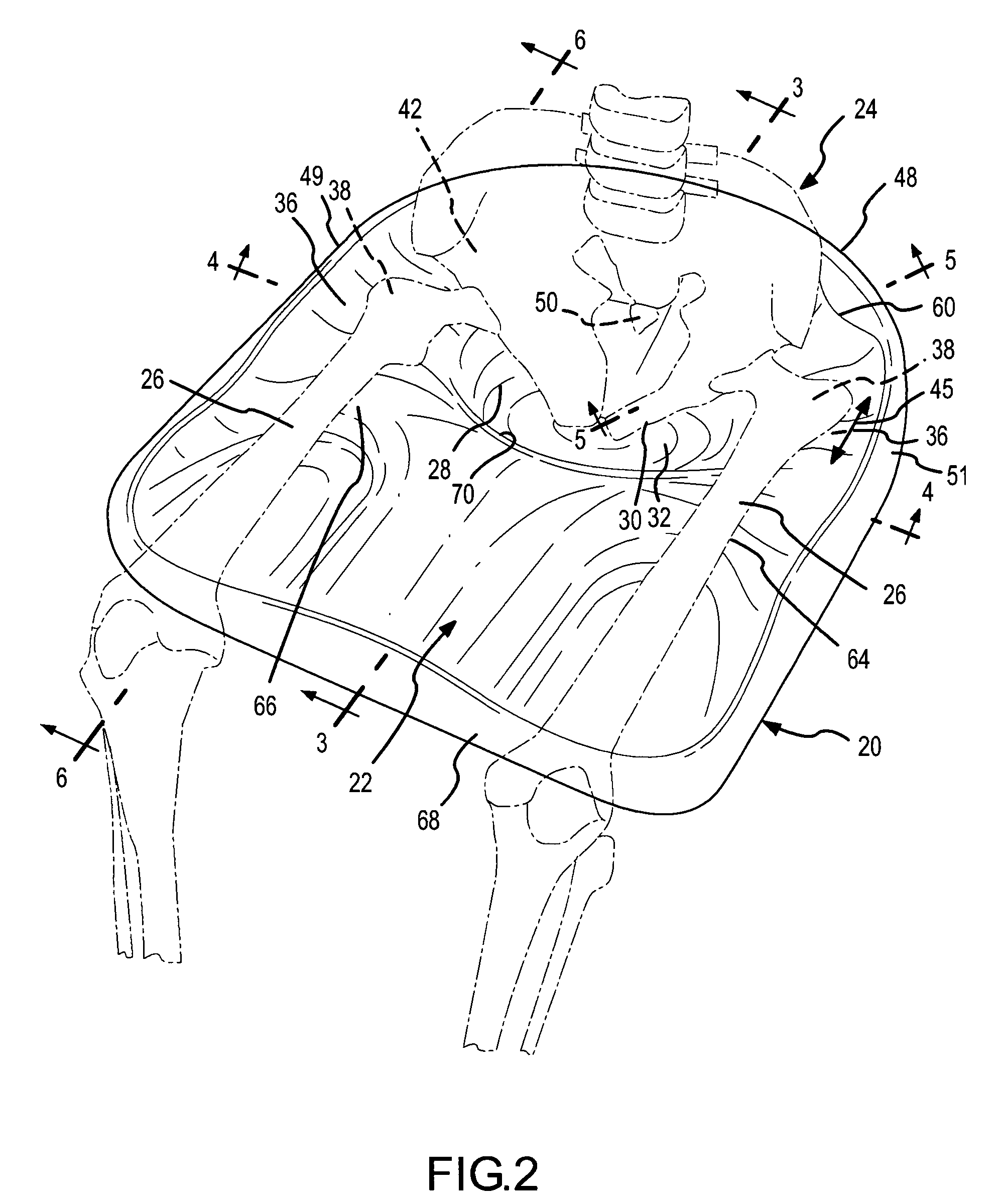Contoured seat cushion and method for offloading pressure from skeletal bone prominences and encouraging proper postural alignment