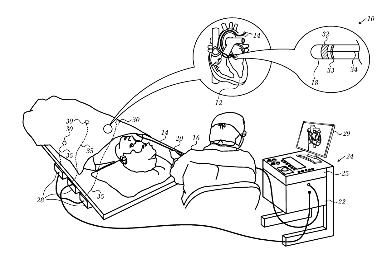 Using Force Sensor to Give Angle of Ultrasound Beam