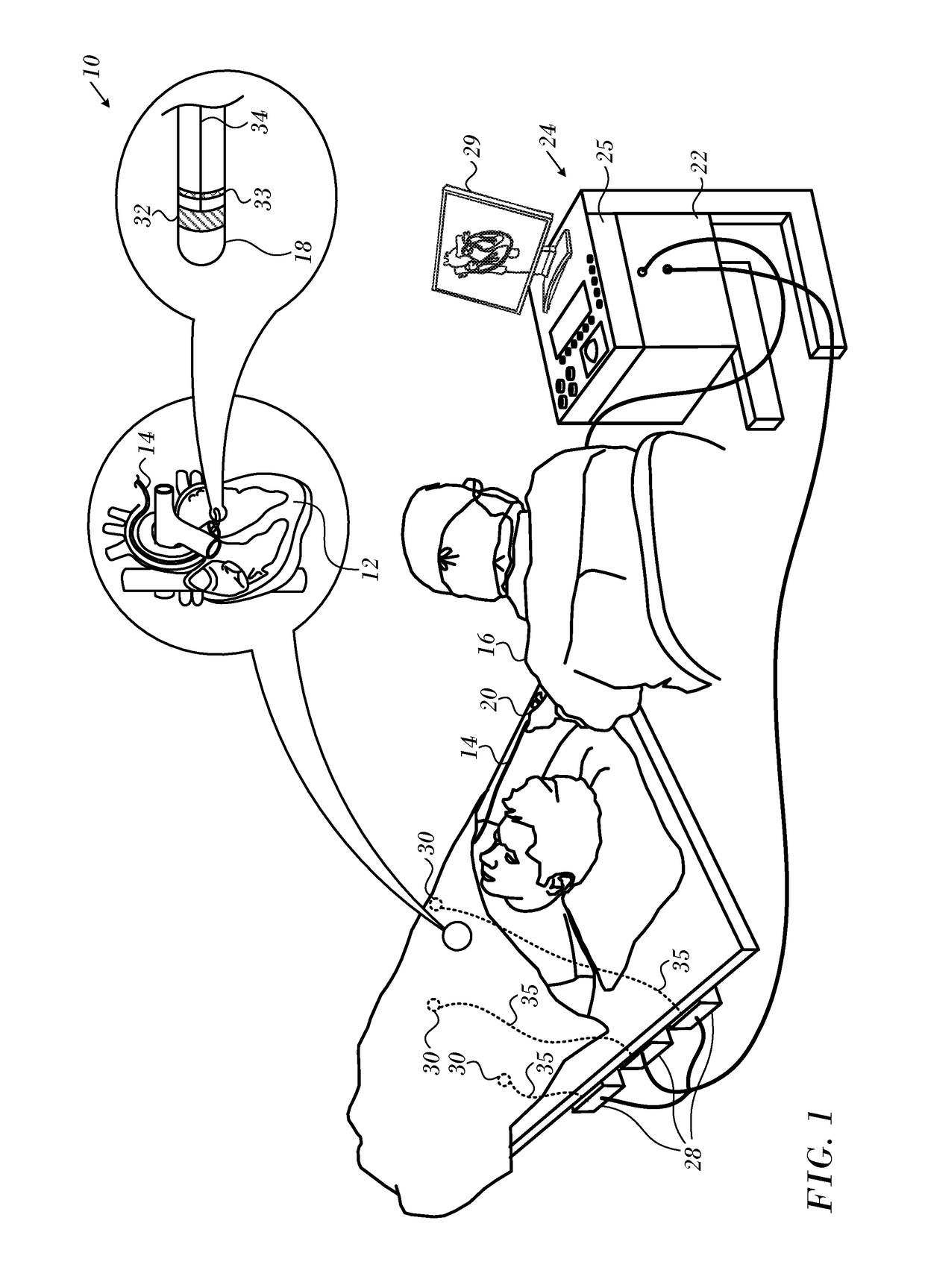 Using Force Sensor to Give Angle of Ultrasound Beam