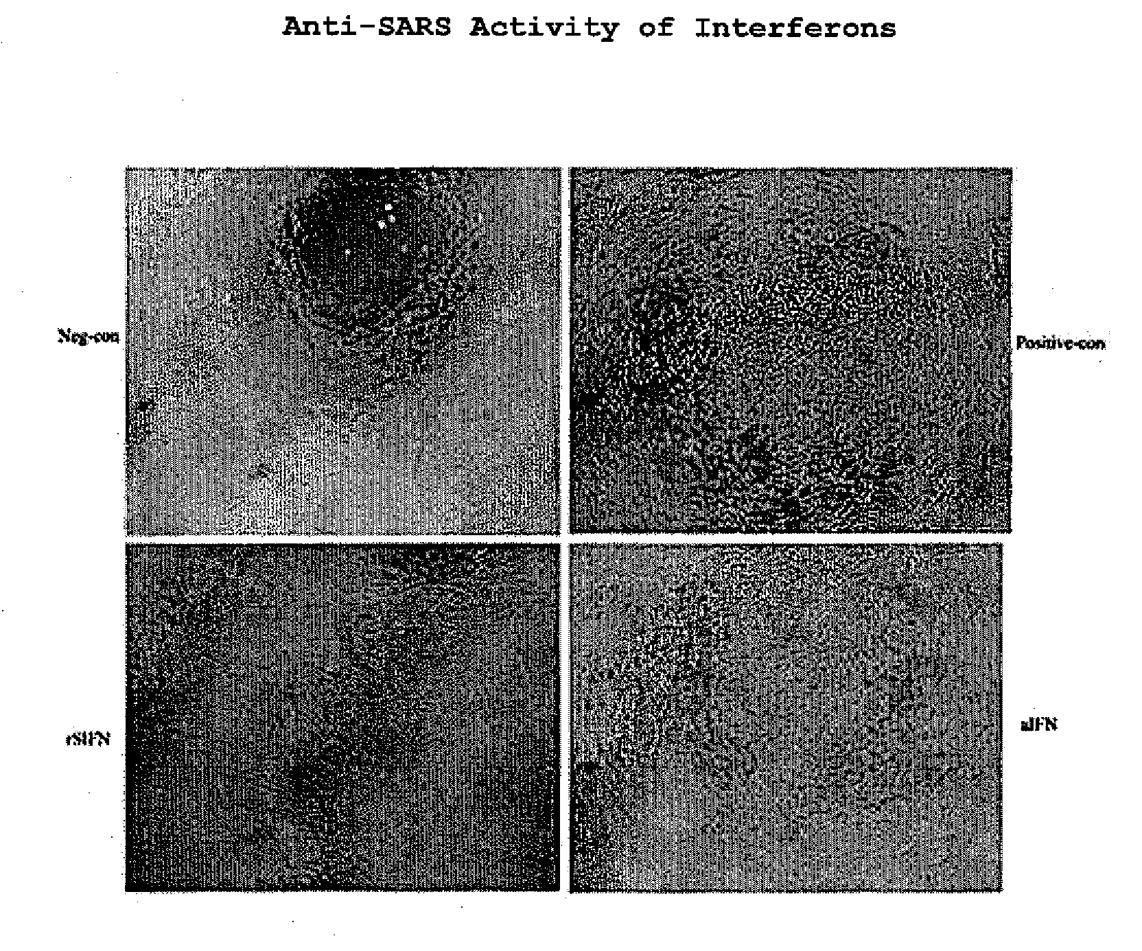 Recombinant super-compound interferon and uses thereof