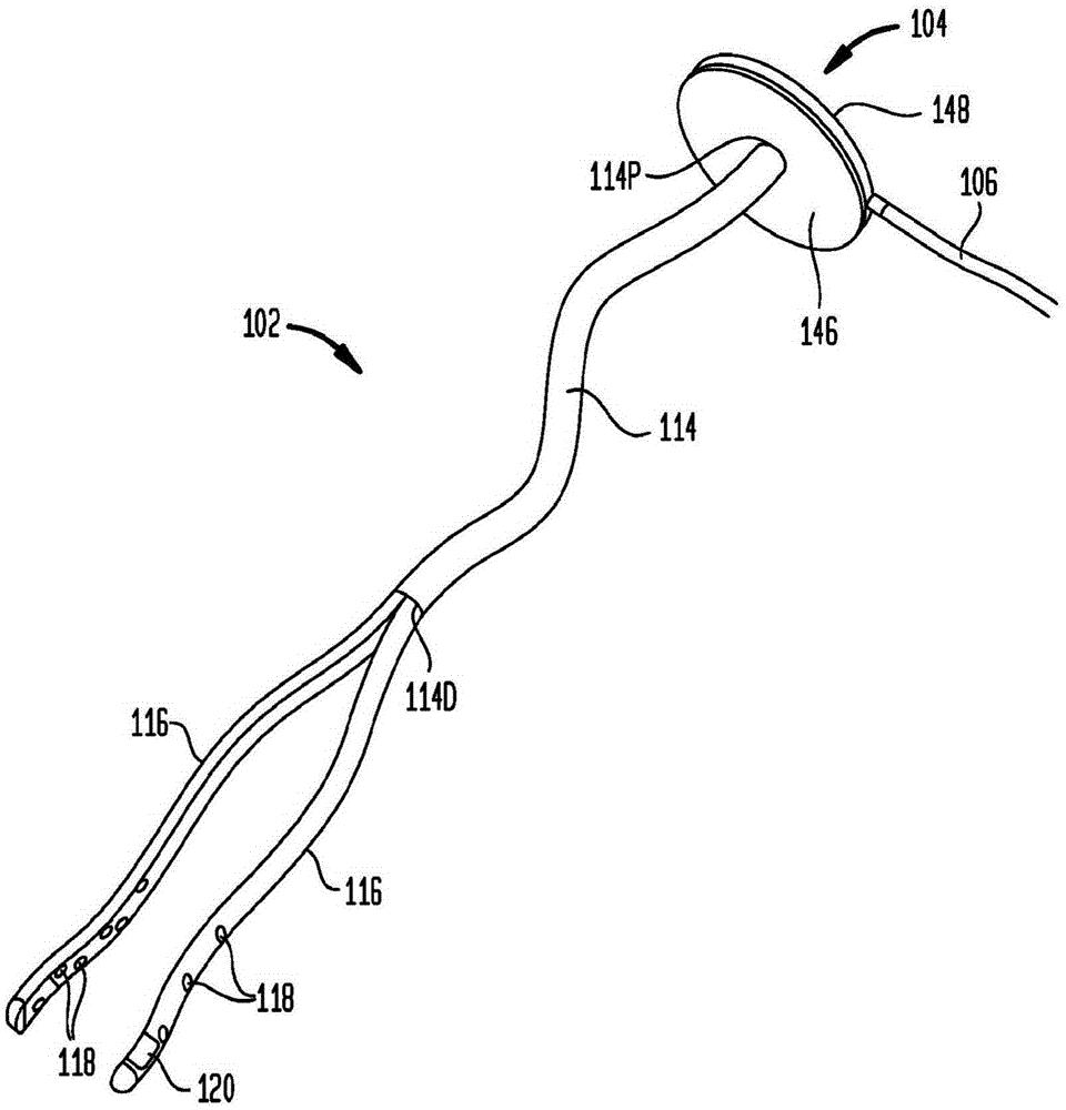 Systems and methods for shunting fluid