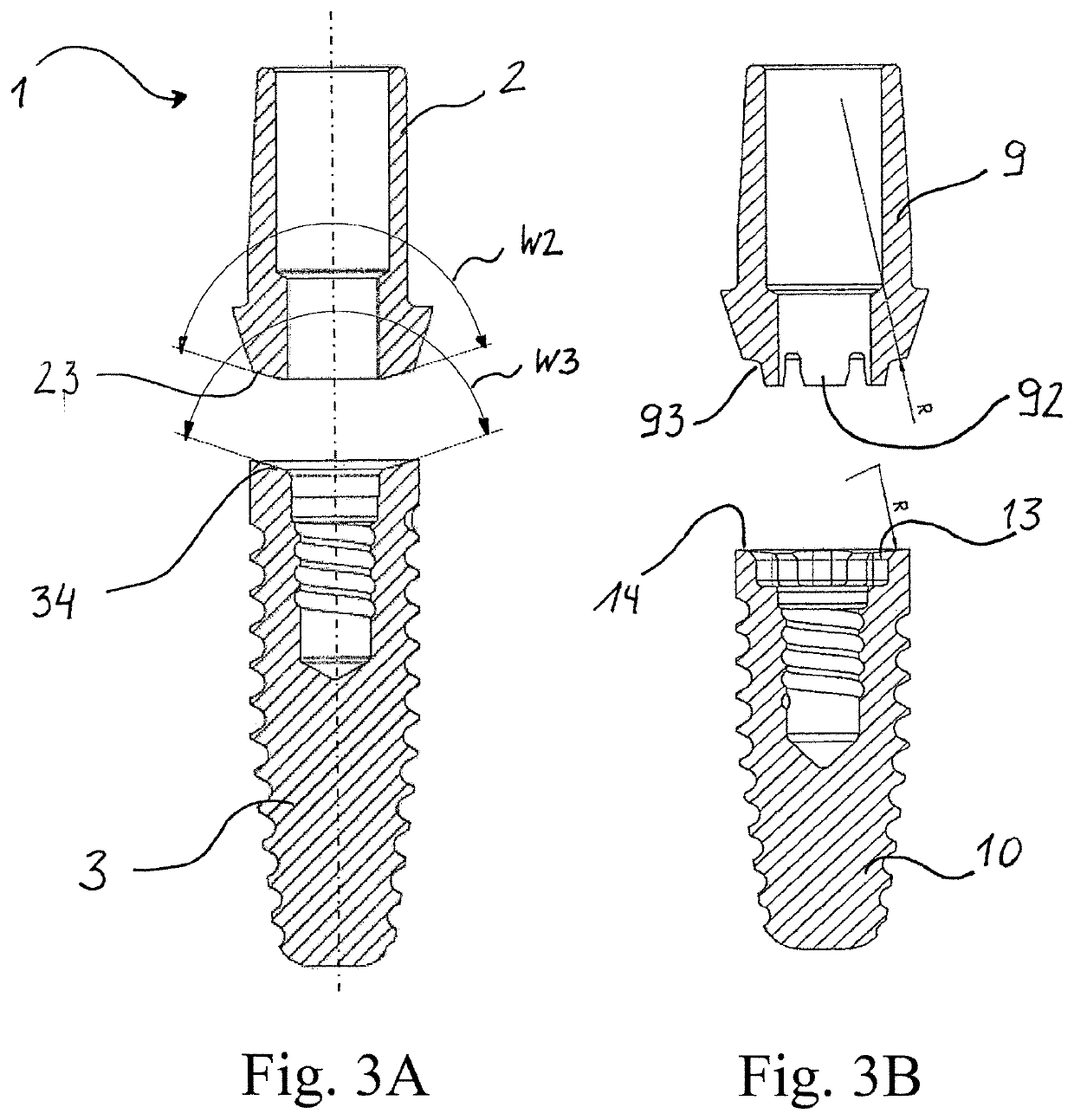 Dental prosthesis system