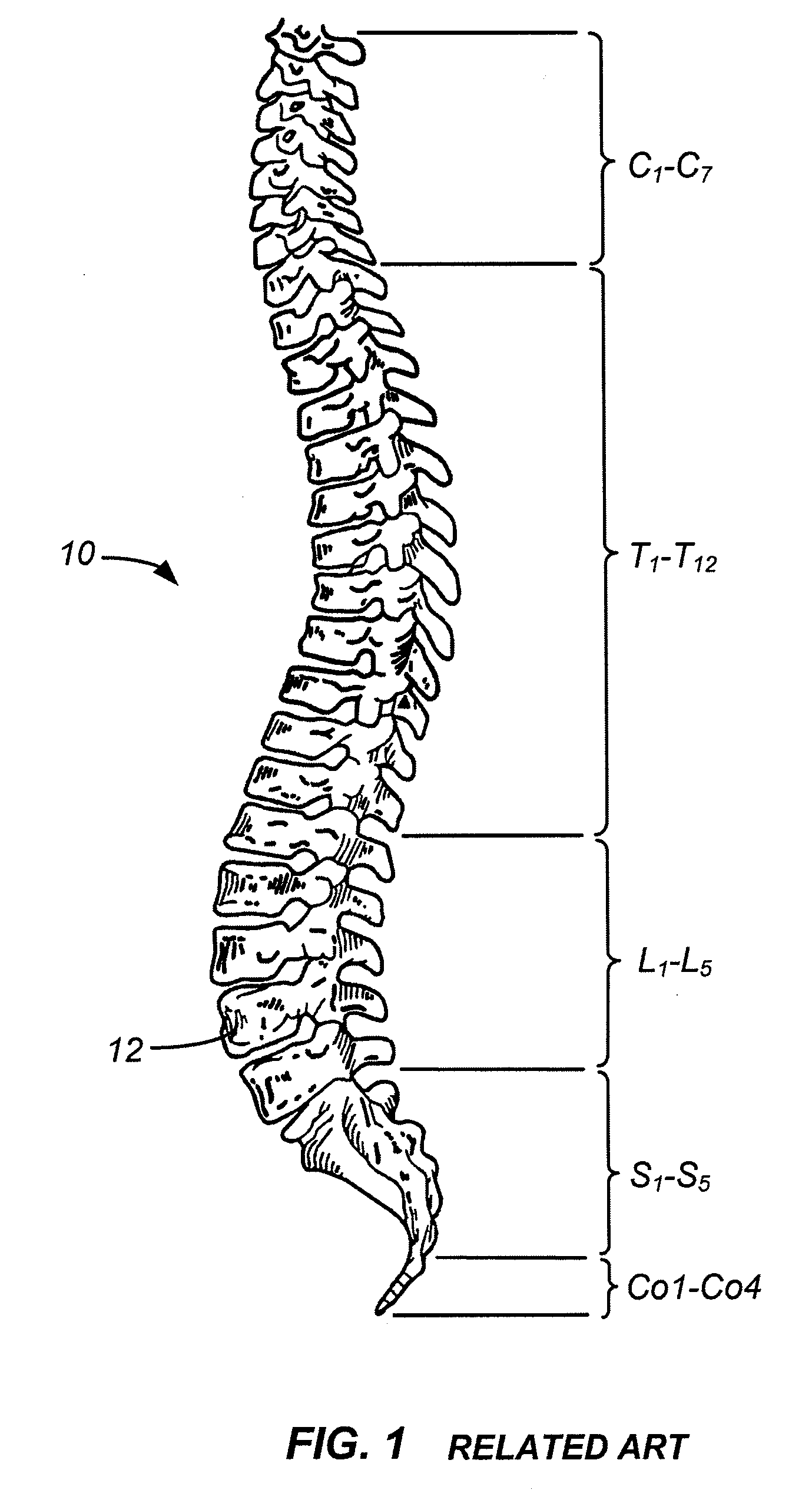 Implantable orthopedic device component selection instrument and methods