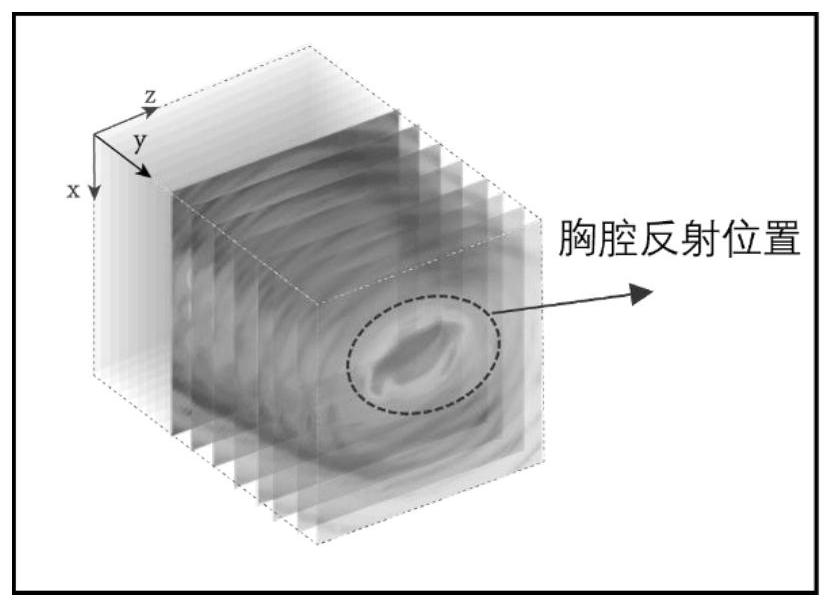 Non-contact electrocardiogram monitoring method based on millimeter wave radar