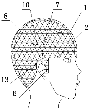 Intelligent acupuncture and moxibustion diagnosis and treatment instrument for treating migraine