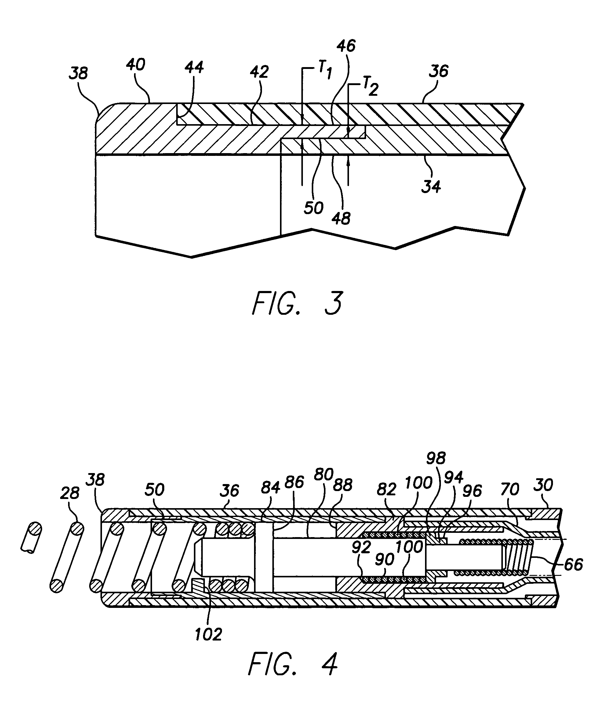 Active fixation lead with multiple density