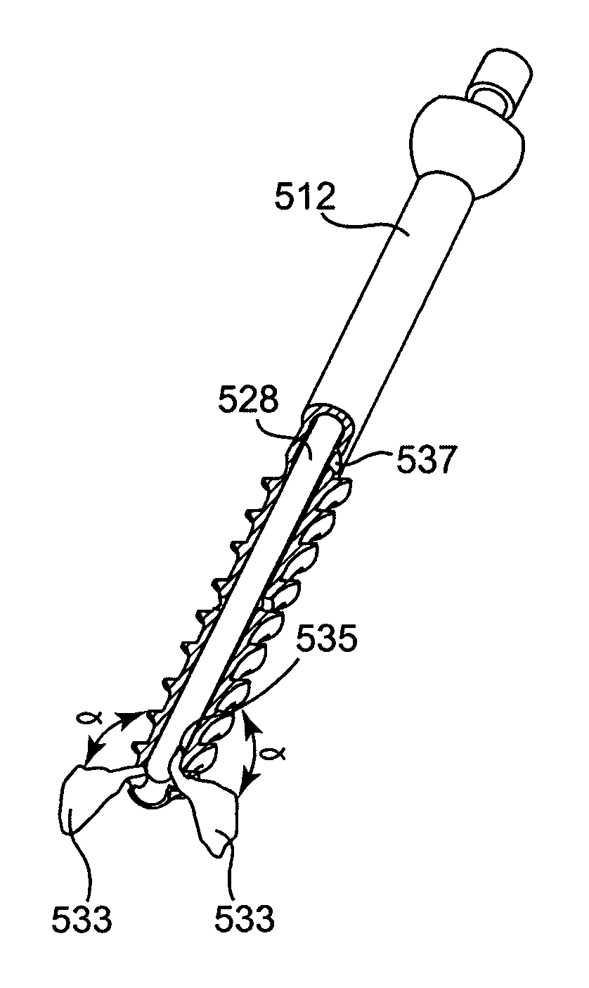 Bone screw with fluid delivery structure