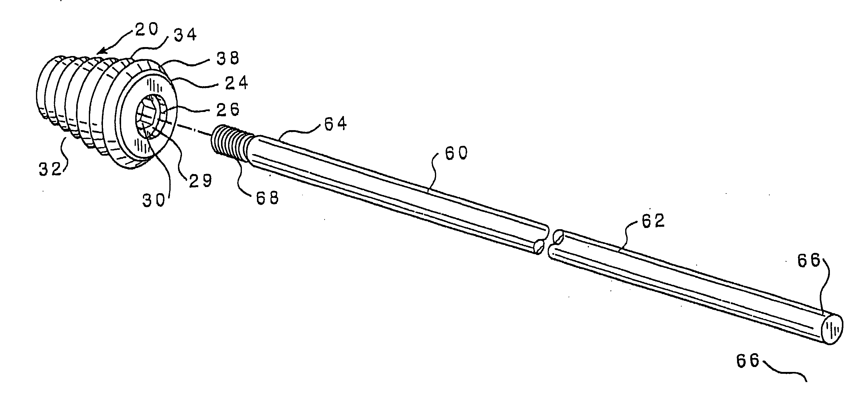 Subtalar implant and methods of use thereof