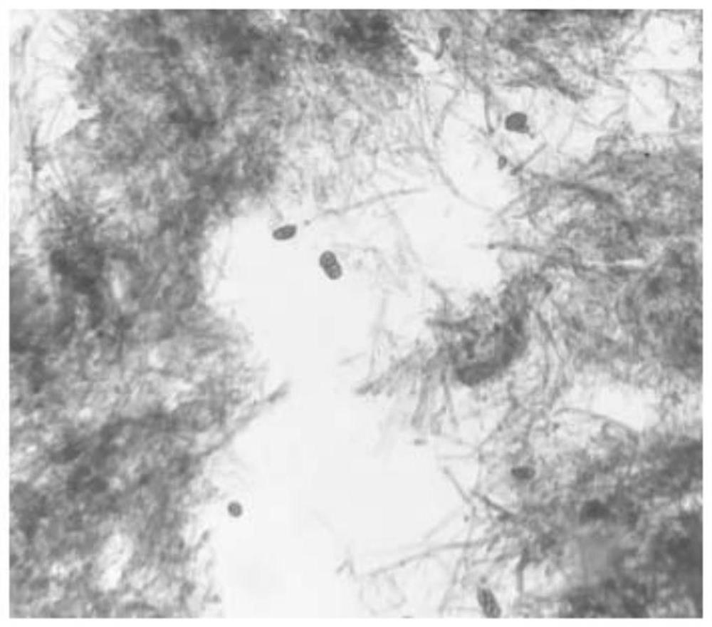 A method for the stable germination of conidia of tomato gray leaf spot and its use for artificial inoculation identification at the seedling stage