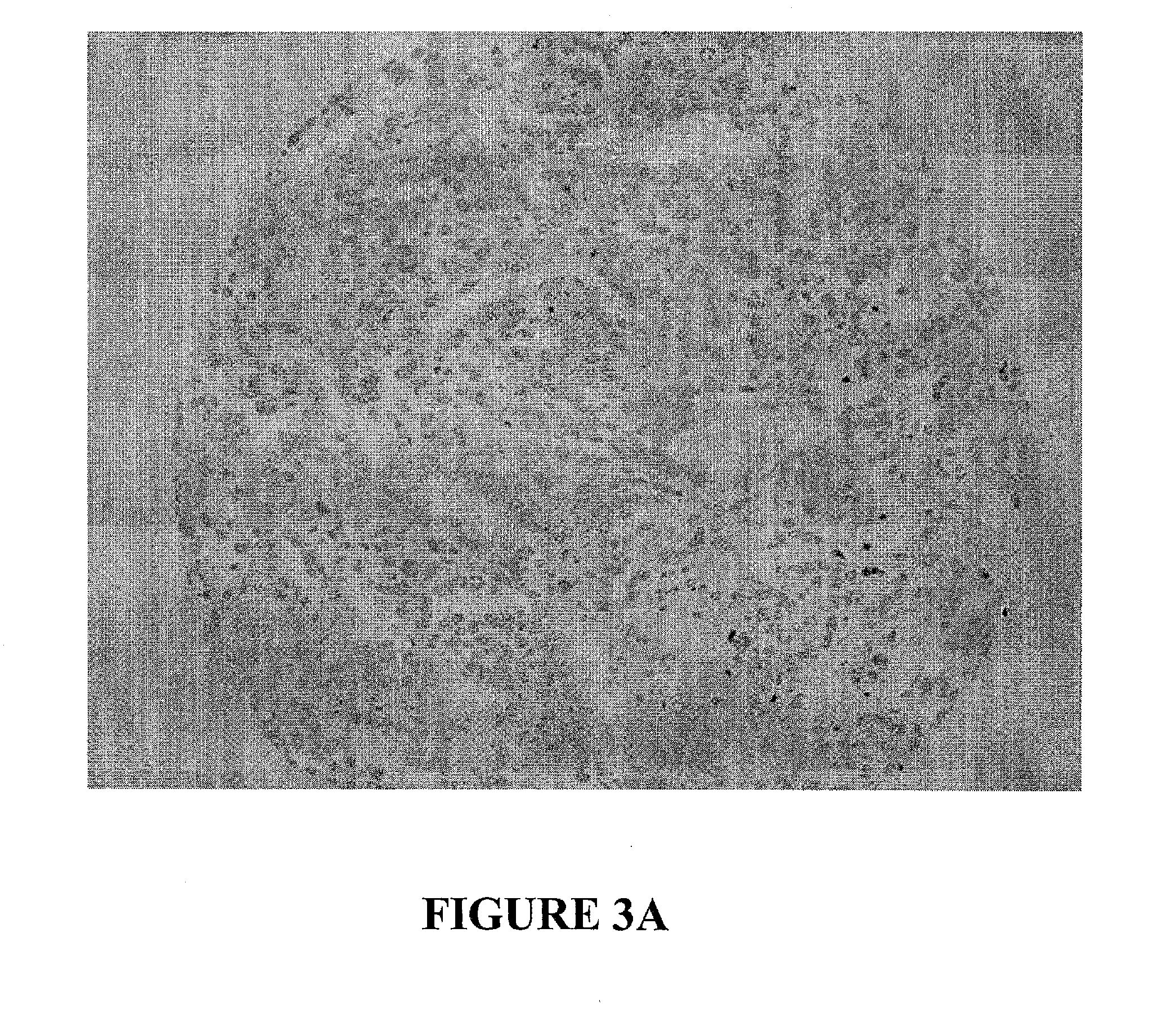 Antibodies to muc16 and methods of use thereof