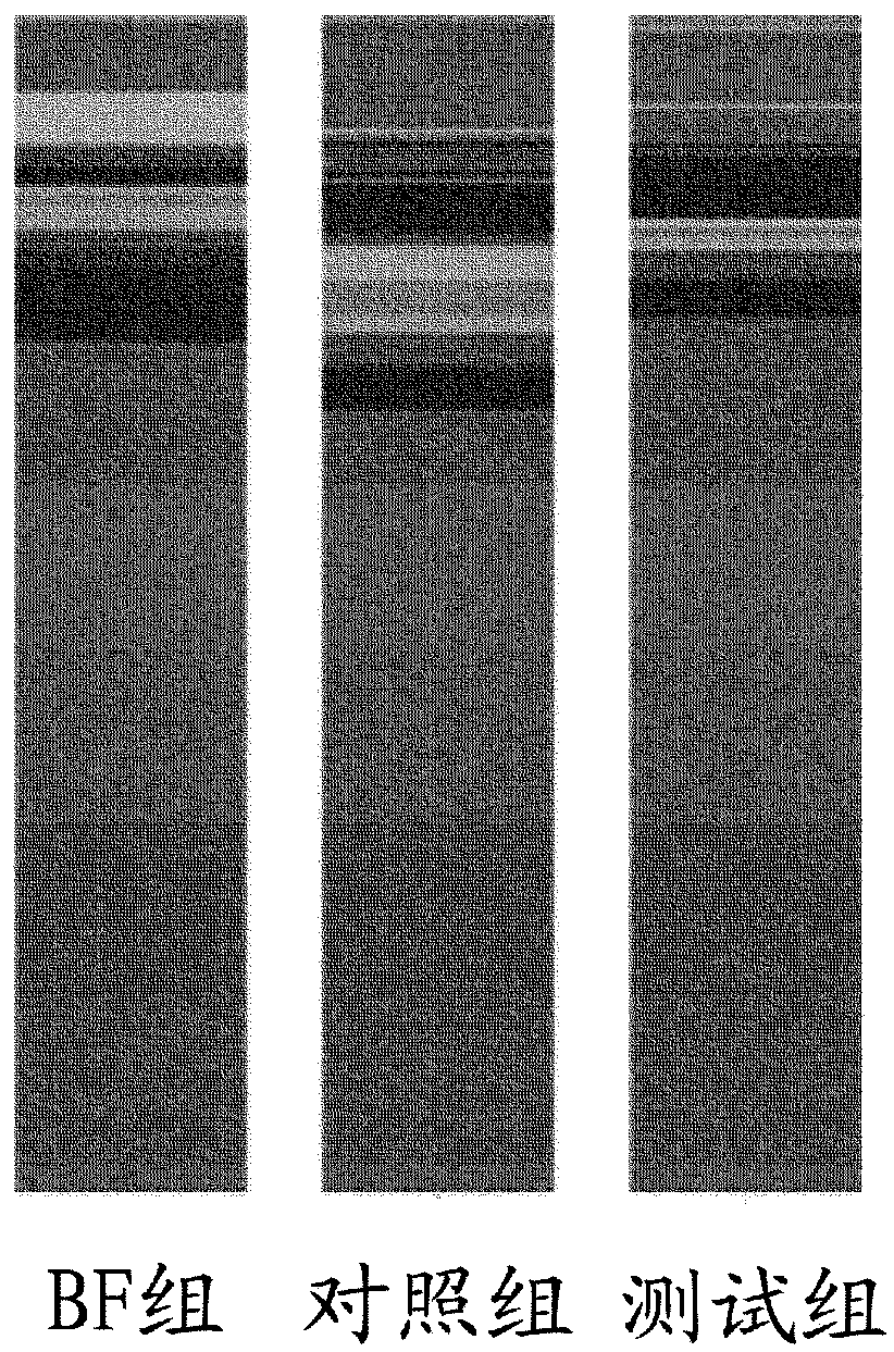 Nutritional compositions with 2fl and lnnt for use in preventing and/or treating non-rotavirus diarrhea by acting on the gut microbiota dysbiosis