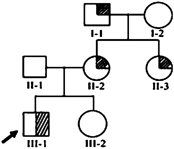 New mutation of scn1a gene in hereditary epilepsy with febrile seizures plus