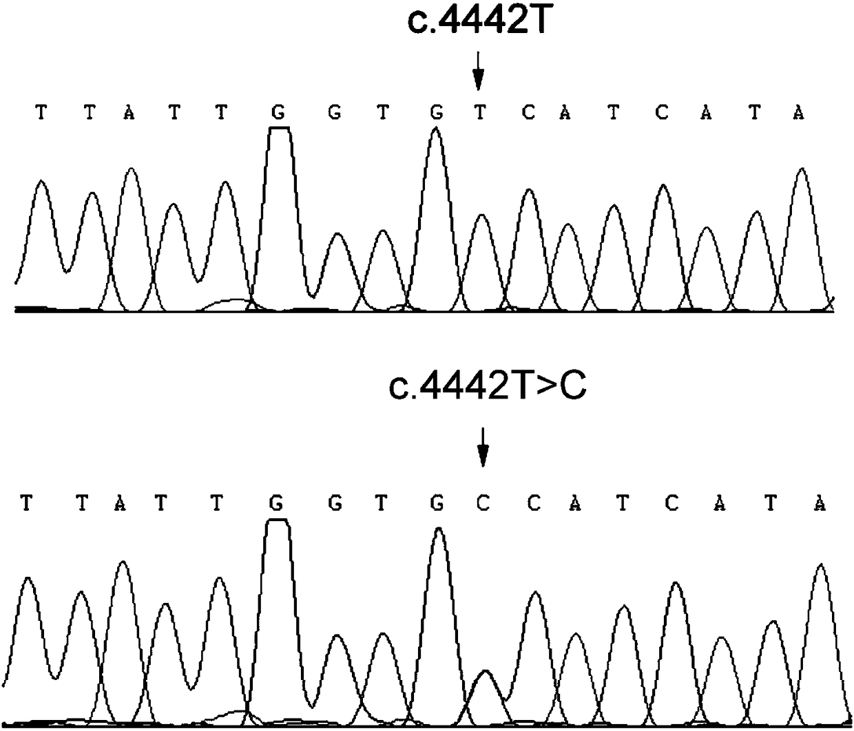 New mutation of scn1a gene in hereditary epilepsy with febrile seizures plus