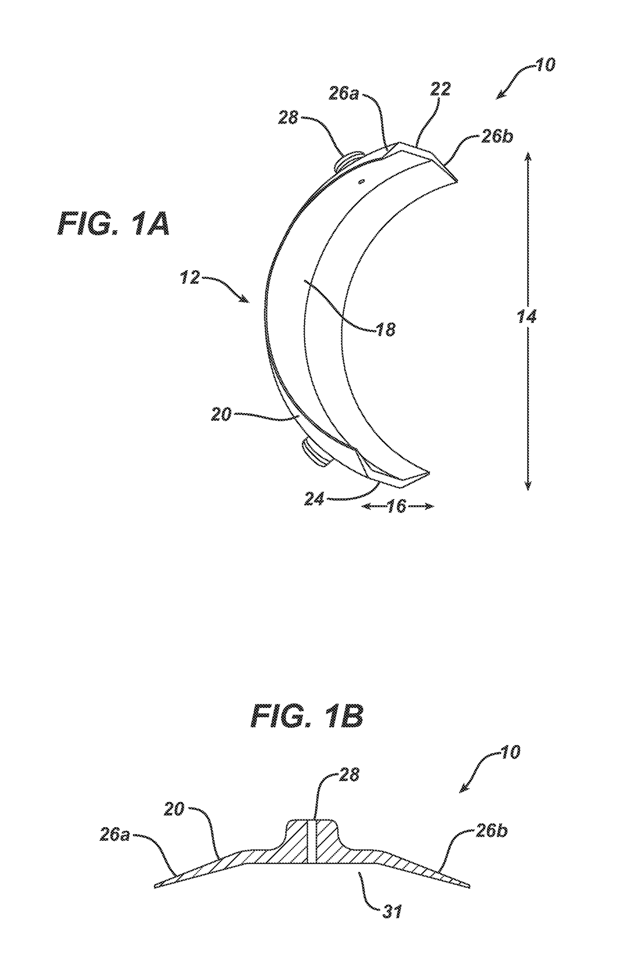 Device and method for the application of a curable fluid composition to a bodily organ
