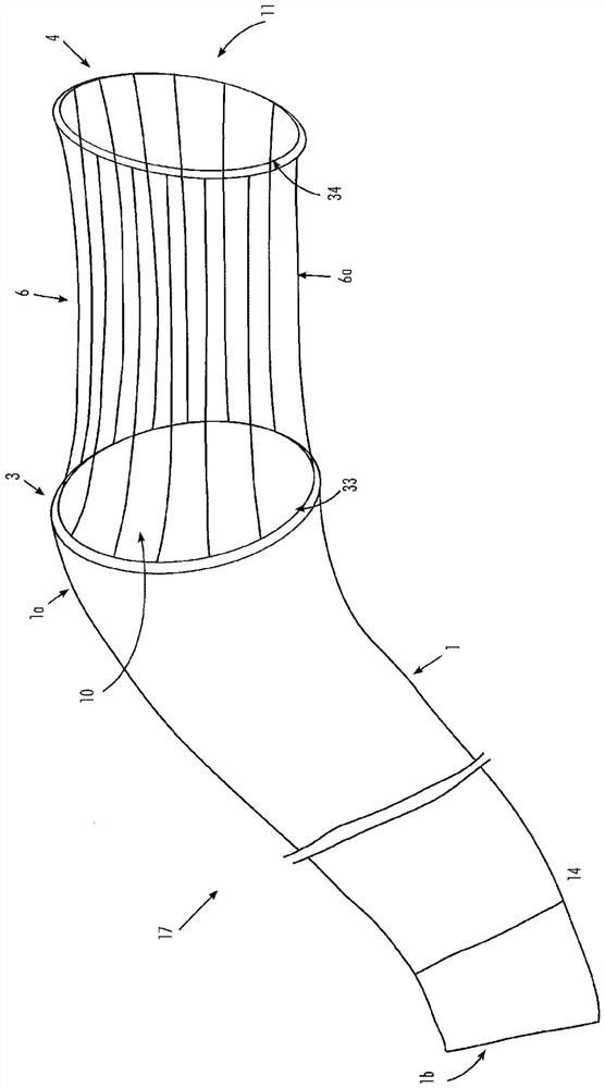 Gastrointestinal implant and positioning device for same
