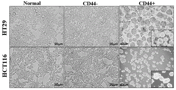 Inhibition application of respiratory chain compound V in colorectal cancer stem cell treatment