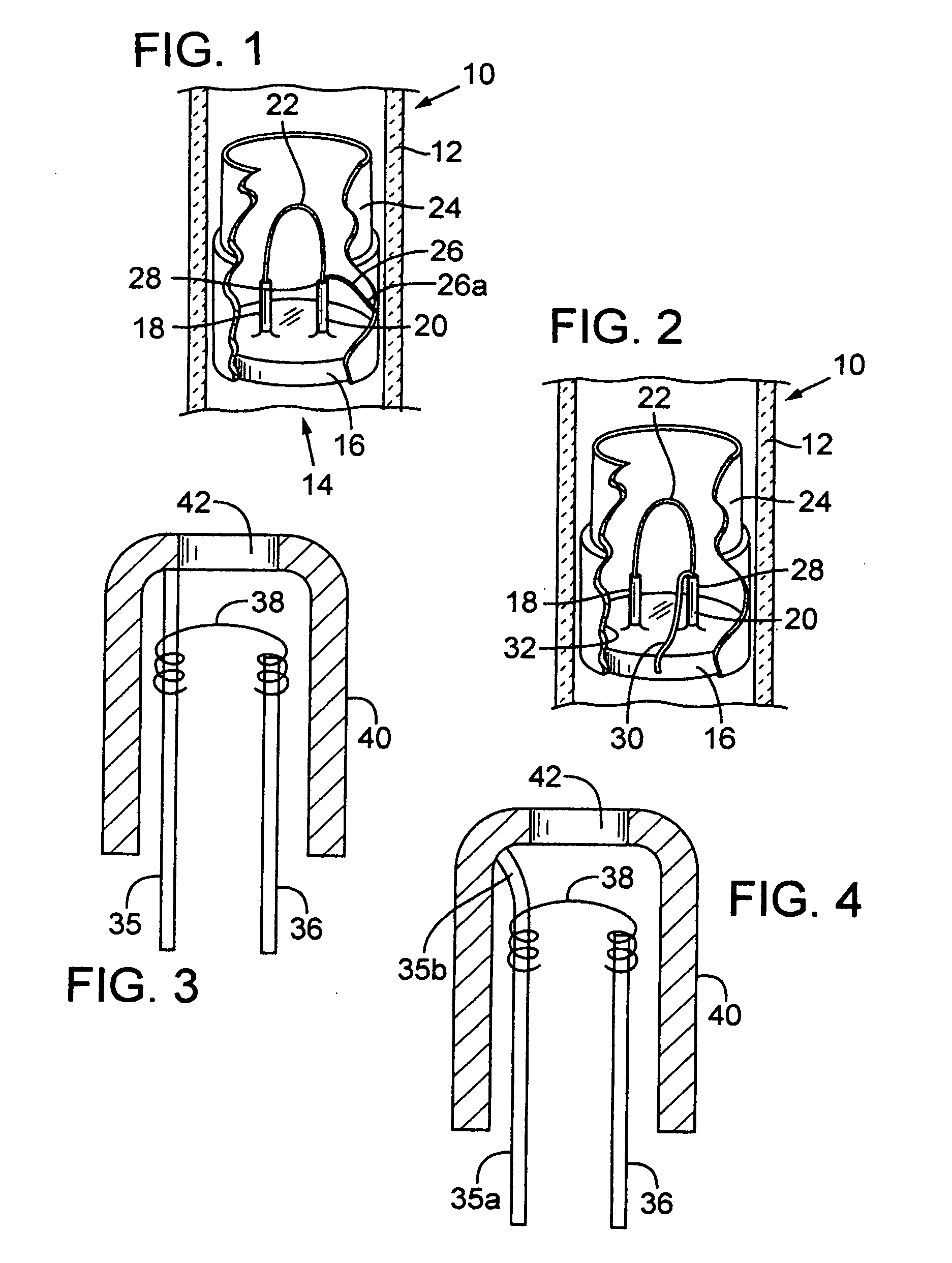 Extractor cup on a miniature x-ray tube