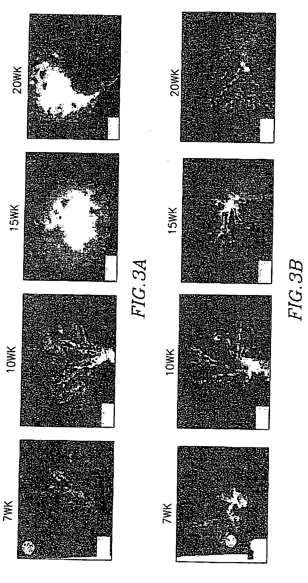 Method for treatment and chemoprevention of prostate cancer