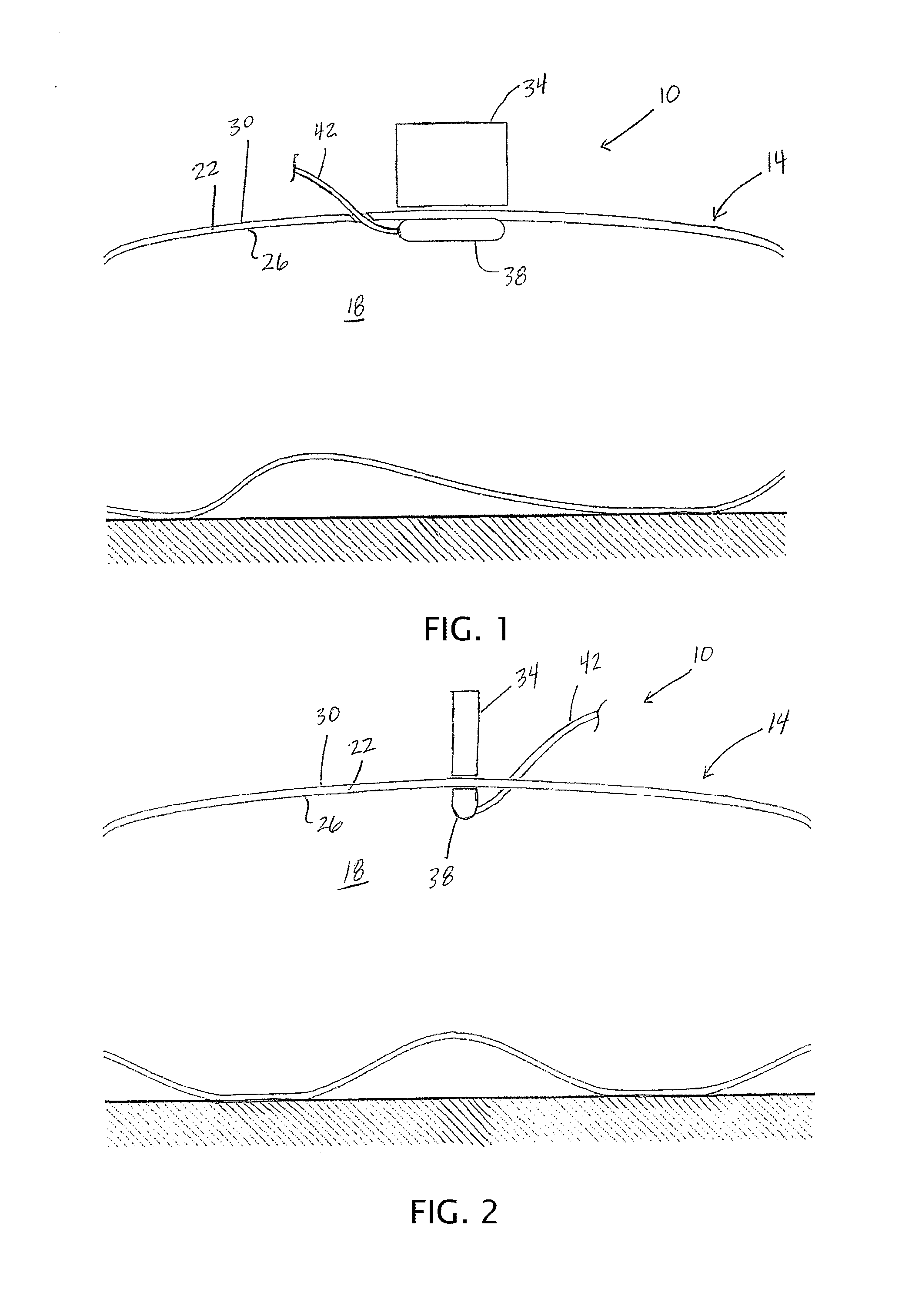 Medical Devices, Apparatuses, Systems, and Methods With Configurations for Shaping Magnetic-Fields and Interactions