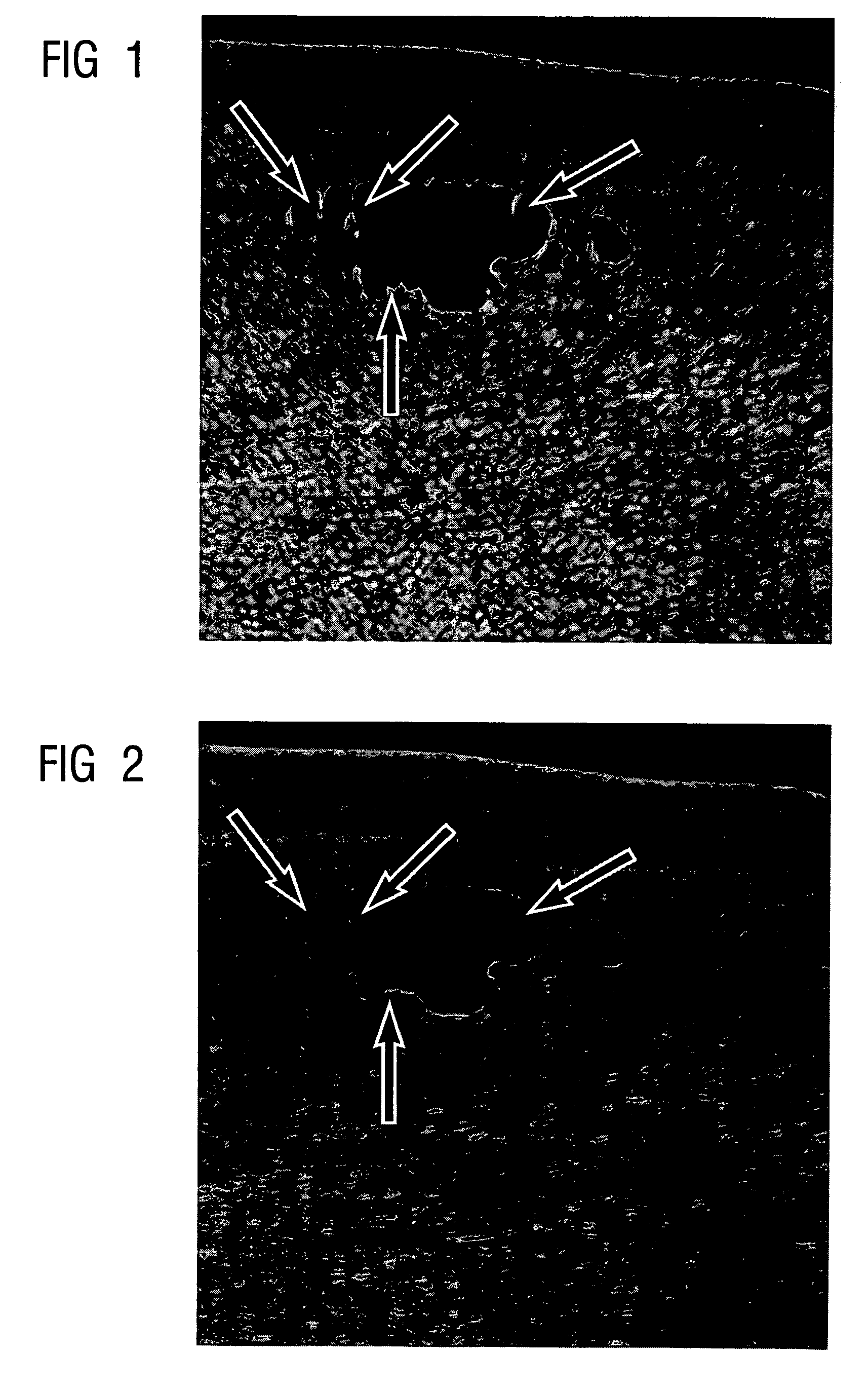 Method for filtering tomographic 3D images after completed reconstruction of volume data