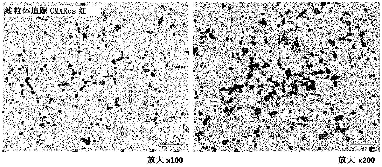 Pharmaceutical composition containing mitochondria