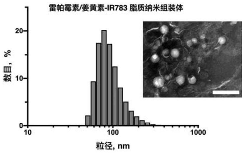 Nano assembly co-loaded with rapamycin and curcumin, preparation method and application thereof