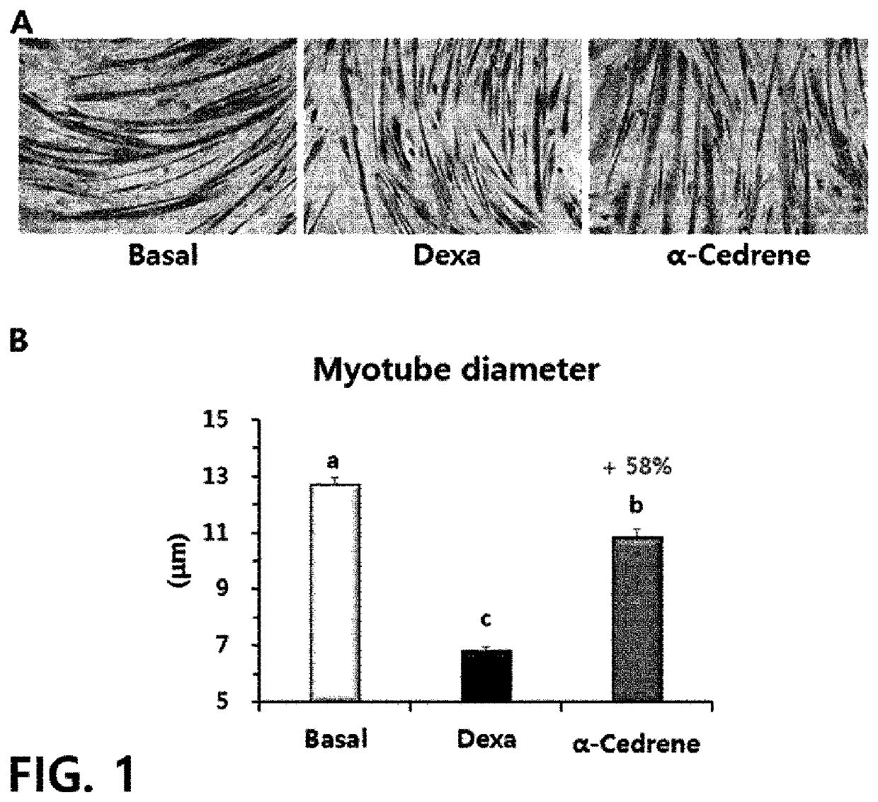 Composition containing sesquiterpene derivative as active ingredient for prevention or treatment of muscle diseases