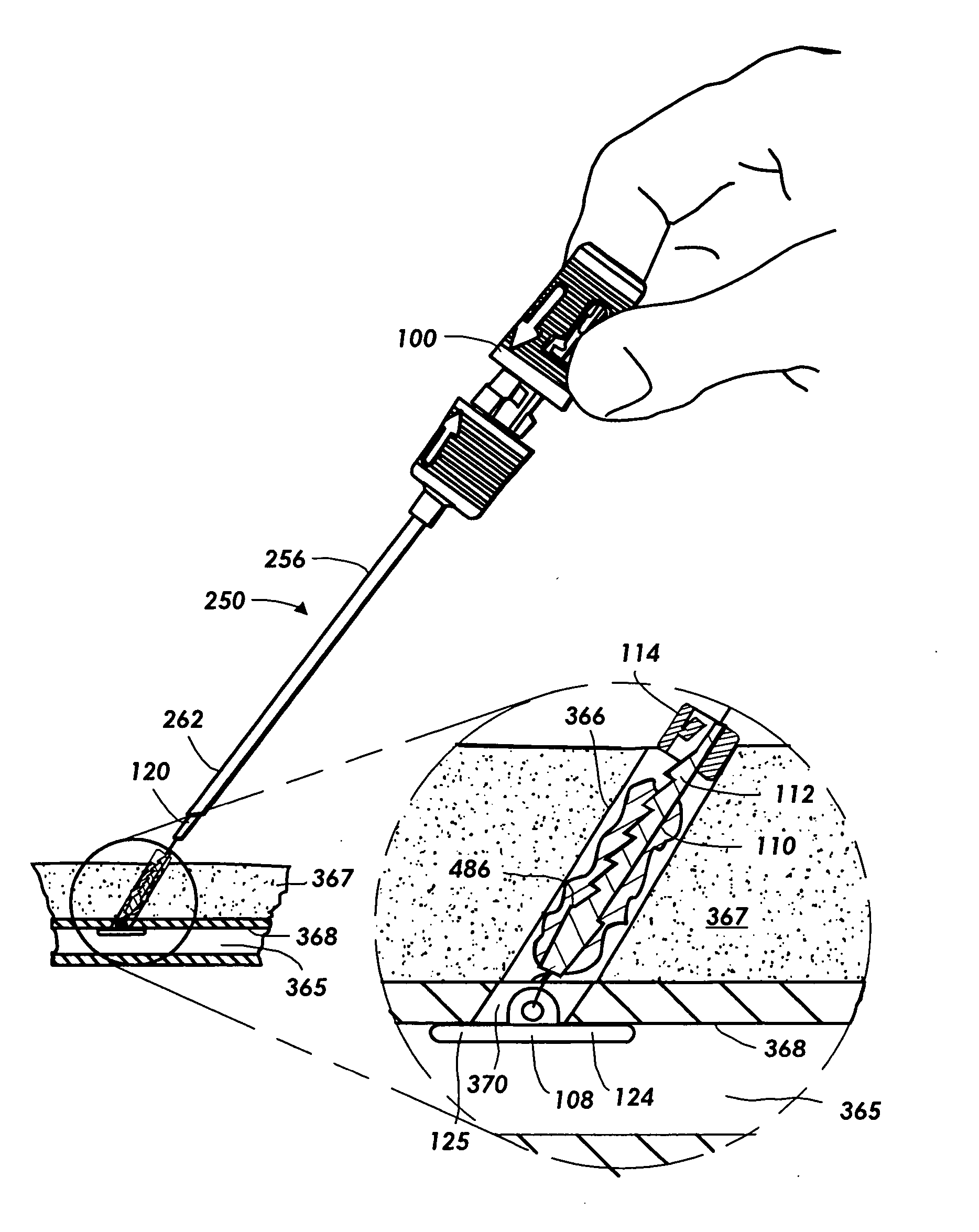 Vascular sealing device with locking hub