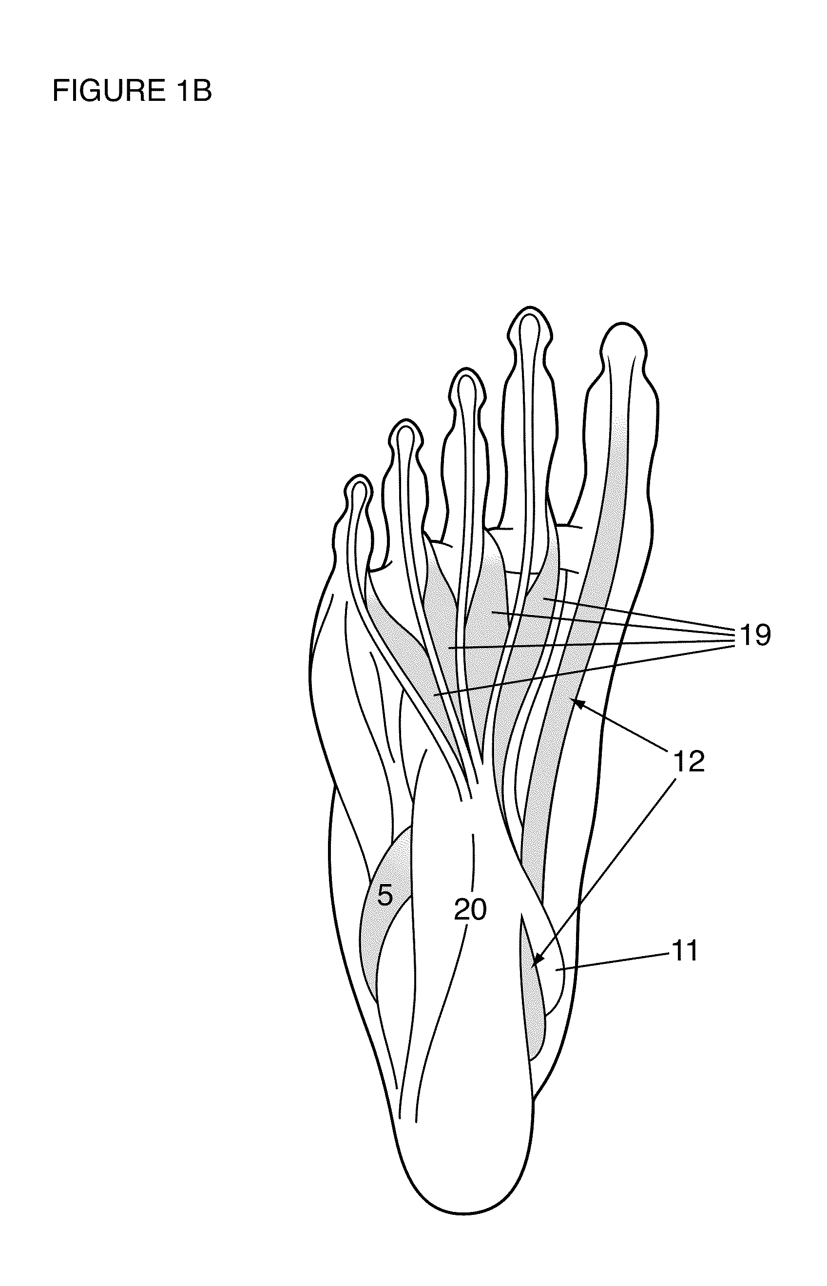 Programmable electrical stimulation of the foot muscles
