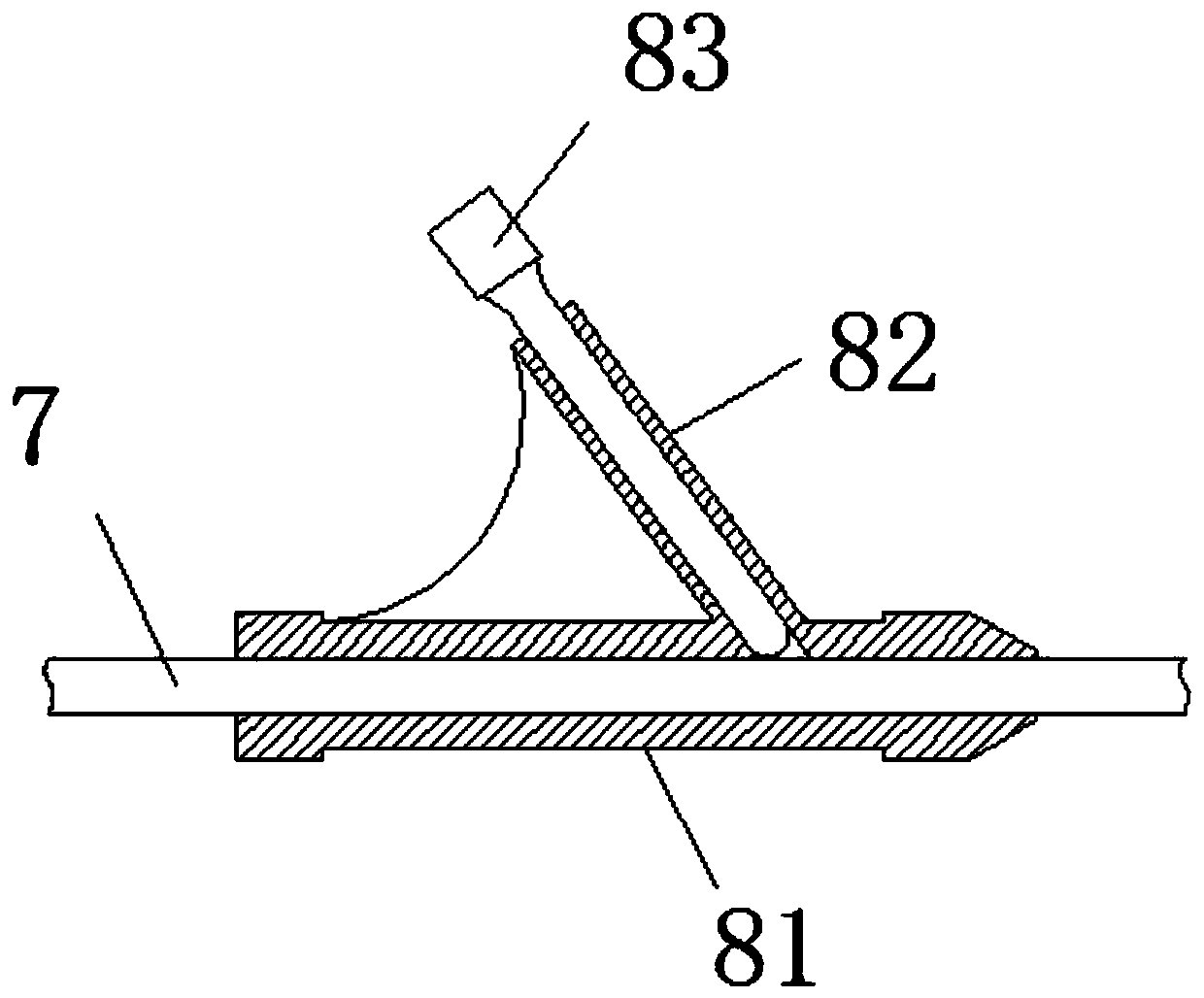 An extrahepatic vascular anastomosis stent and its delivery system