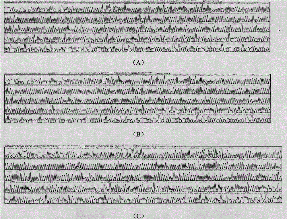 Main outer membrane protein epitope vaccine of chlamydia trachomatis based on HBcAg vector and application of main outer membrane protein epitope vaccine