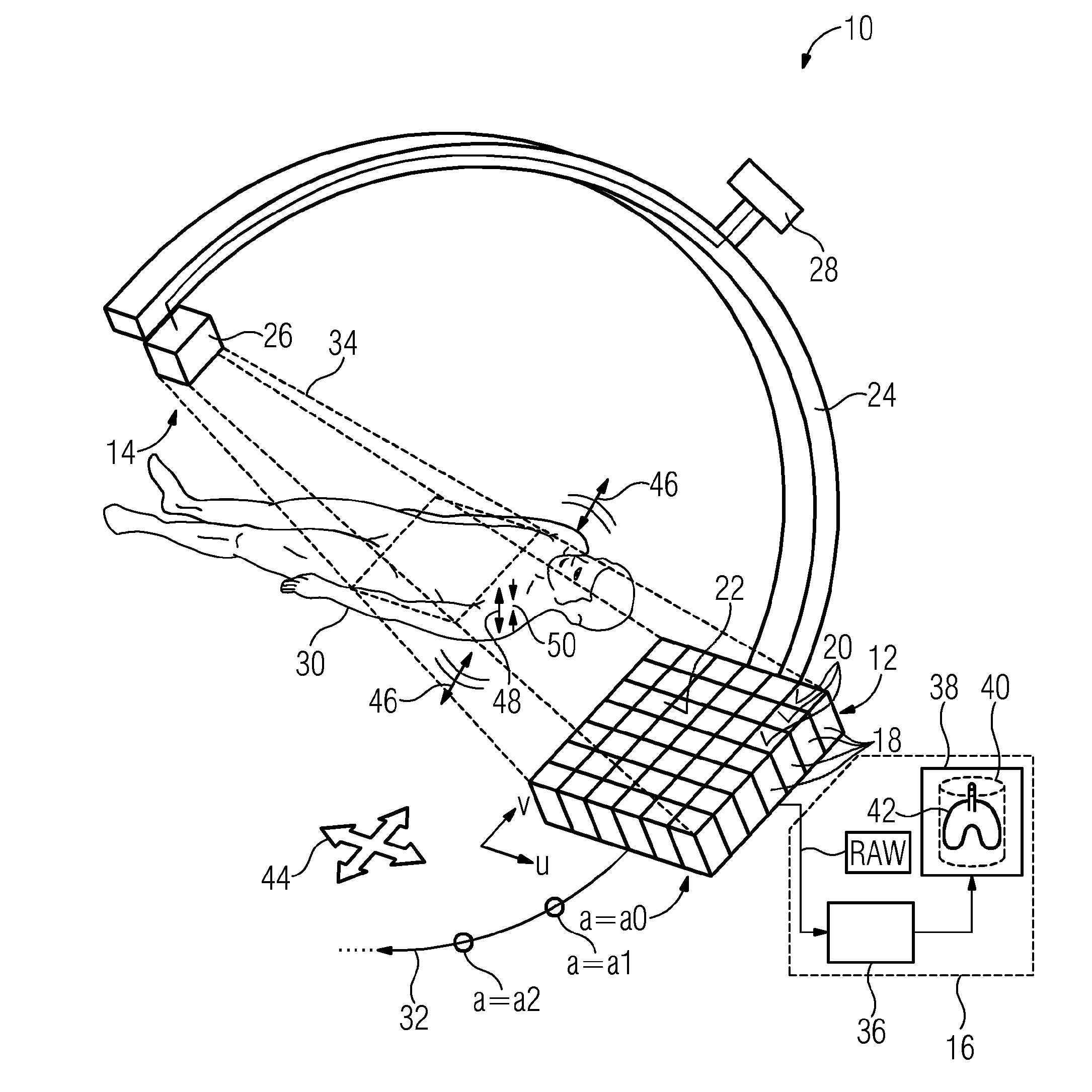 Computed tomography having motion compensation