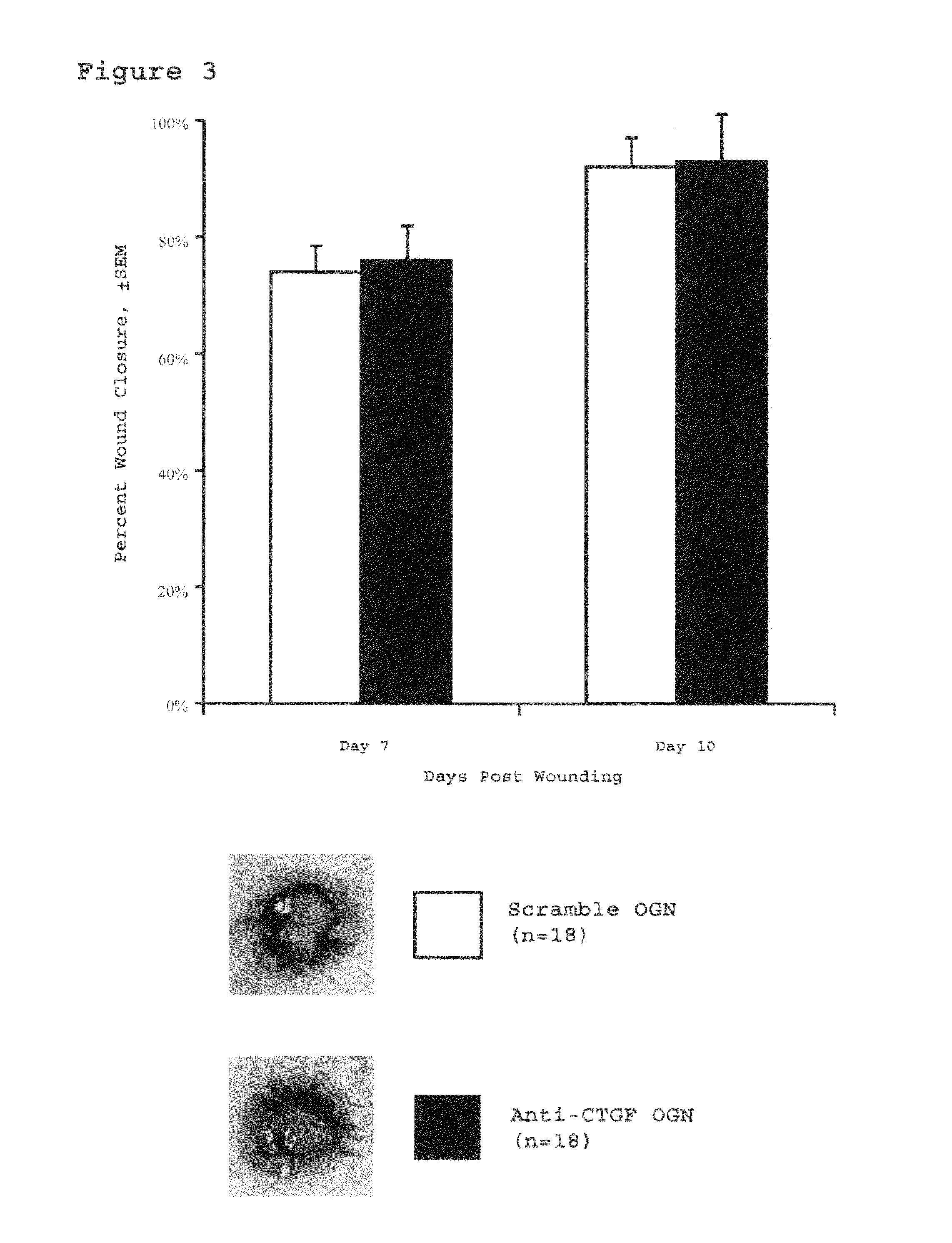 Method for reducing scarring during wound healing using antisense compounds directed to CTGF