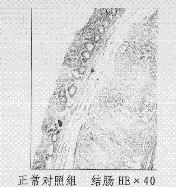 Chinese patent medicament for treating ulcerative colitis