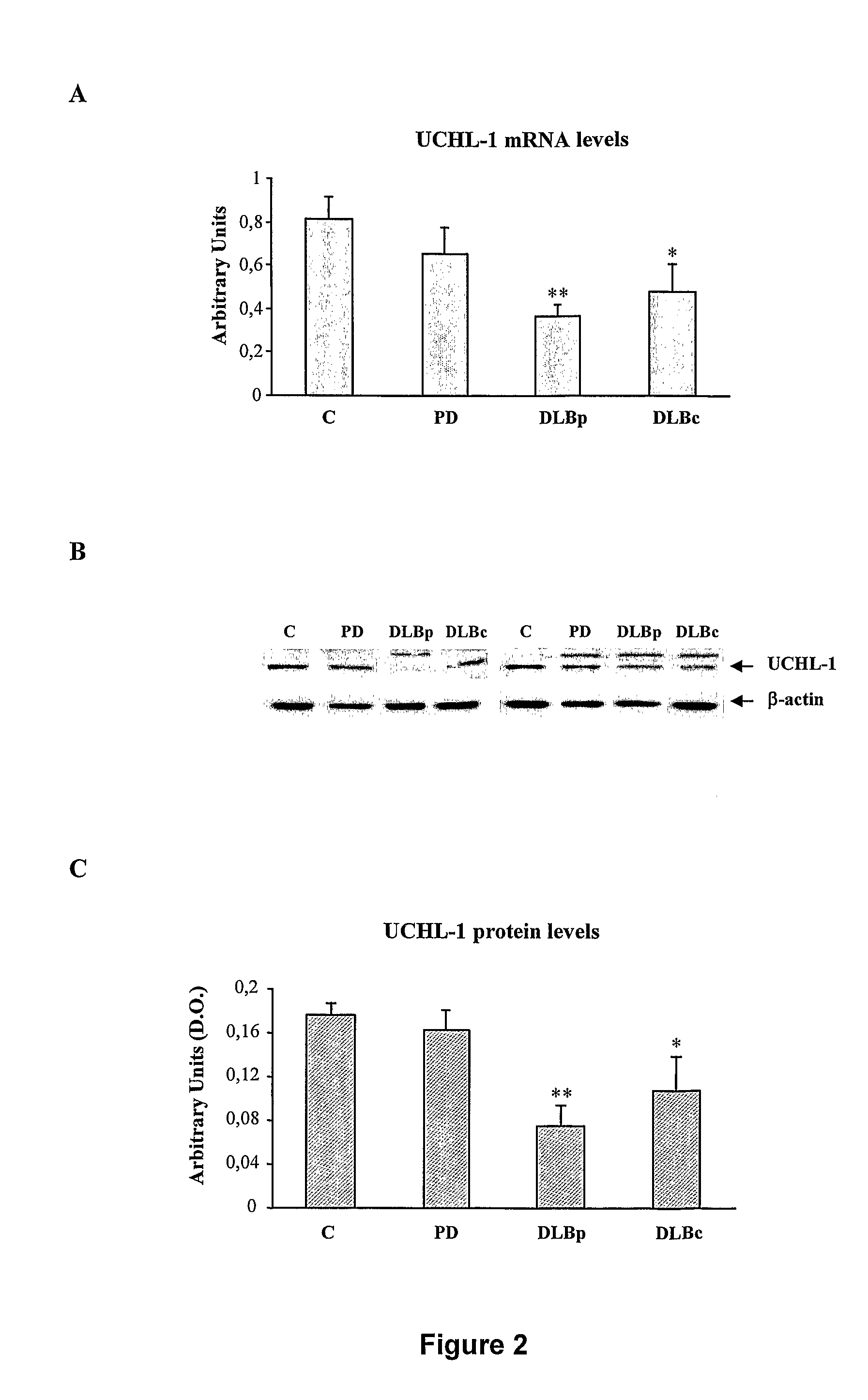 Molecular Diagnostic Method and Treatment in Dementia With Lewy Bodies