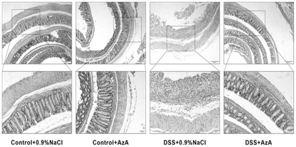 Application of azelaic acid in preparation of medicine for treating inflammatory bowel disease